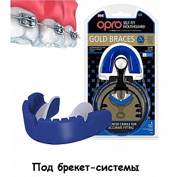 Капа OPRO Gold Braces Blue/Pearl (art.002194002)