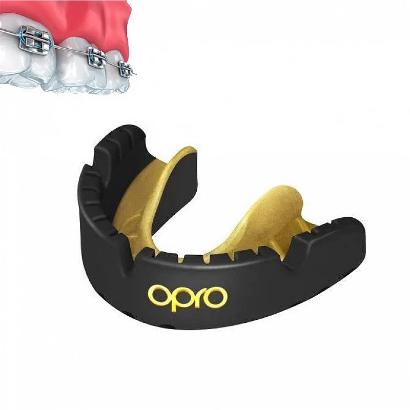 Капа OPRO Gold Braces Black/Goldl фото товару
